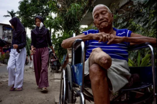 Indonesia Mobilizes Provincial Leaders in New Push to Eliminate Leprosy